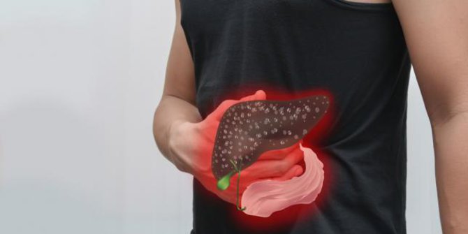 Pengertian Singkat Mengenai Penyakit Hepatitis A